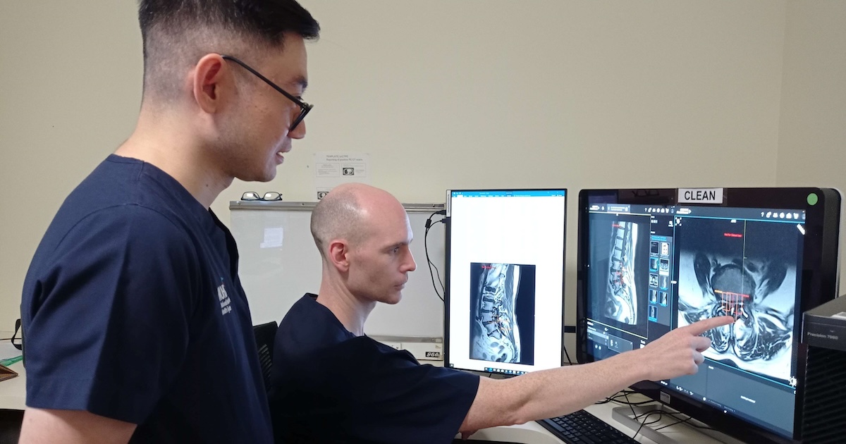 NUH AI interprets spinal stenosis in ’47 seconds’ and more AI briefs