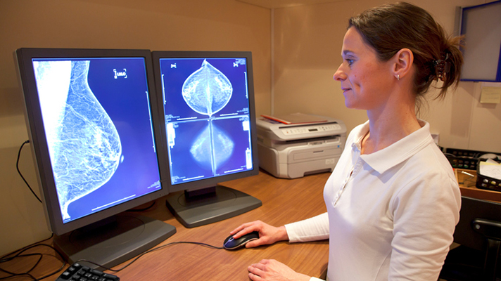 3D mammography tech promises big advantages, but hurdles remain ...