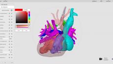 Arc Viewer, a 3D model viewing software for surgeons and other medical professionals