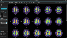 Interface of Heuron Brain PET by South Korean company Heuron