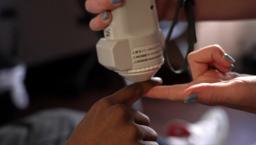 Hands use a Medtronic device on a patient's hand to aid in testing pulse oximetry quality