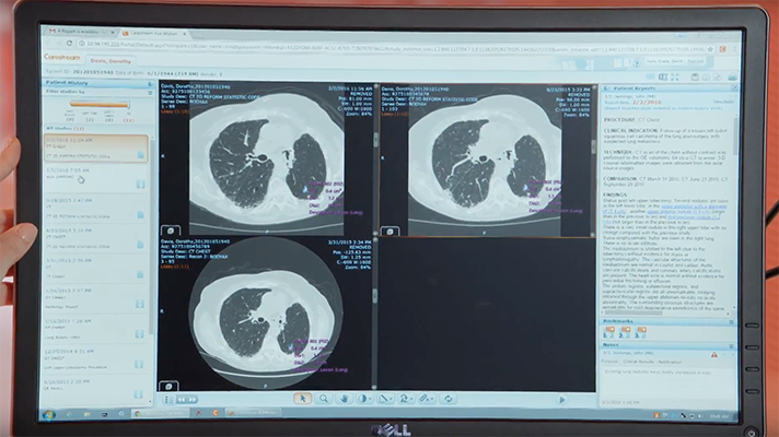 multimedia radiology reports