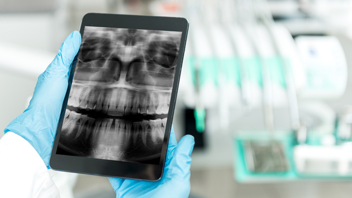 Doctor looking at x-ray on a tablet